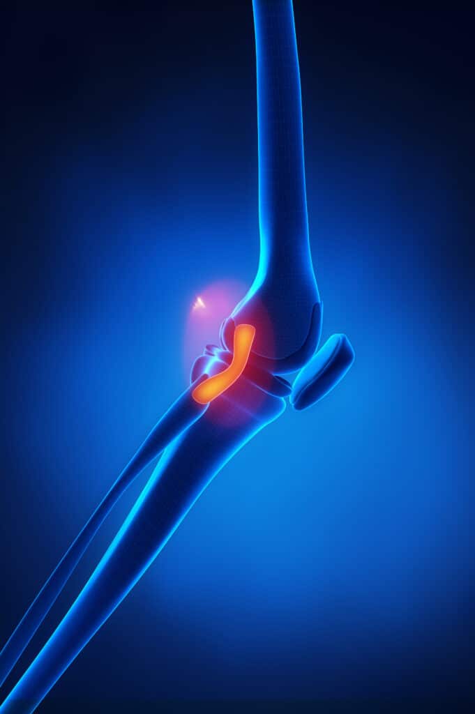 LCL Sprain Anatomy