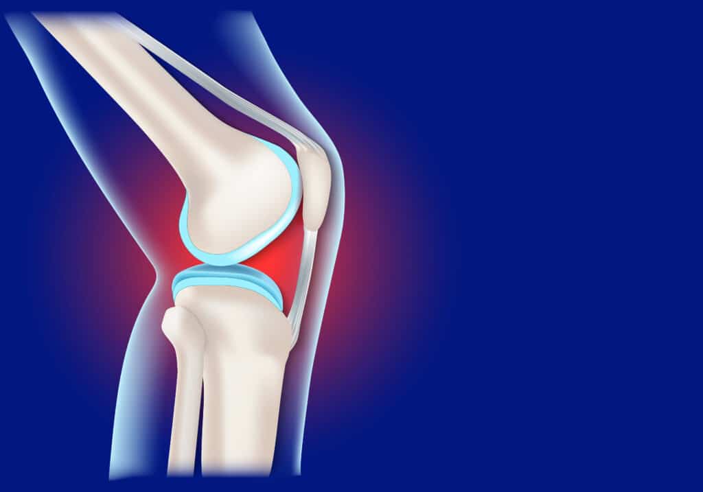 Patellar Tendon Strain Anatomy