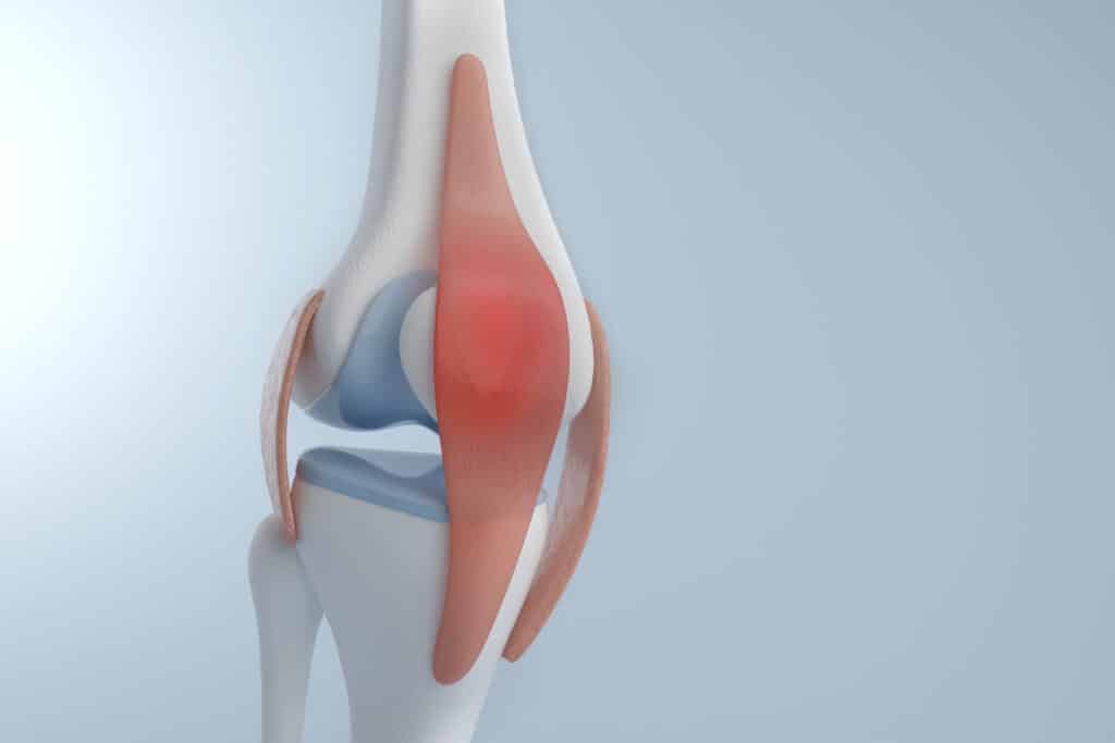Patellar Tendinopathy anatomy