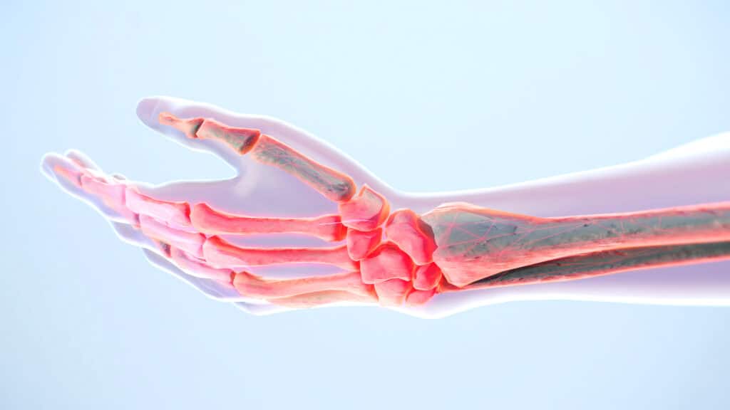 Hand and finger pain anatomy