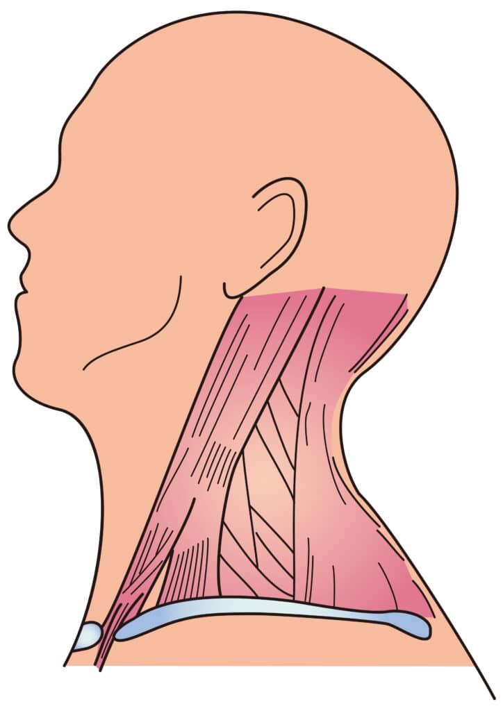 Neck Strain Anatomy