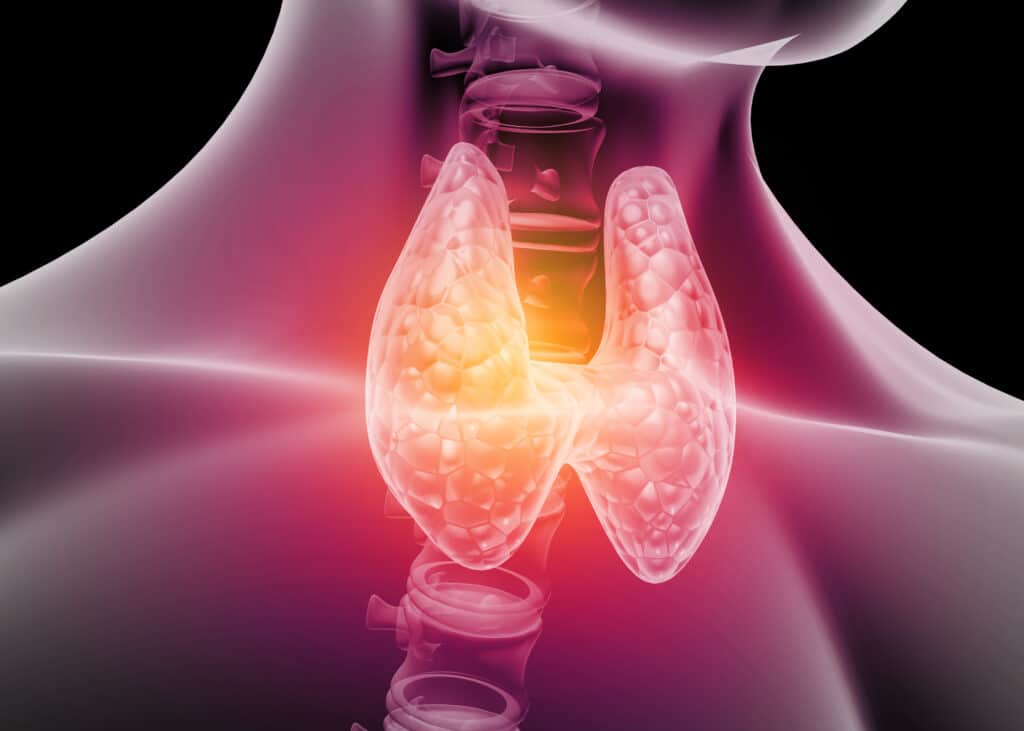 Hyperthyroidism Anatomy