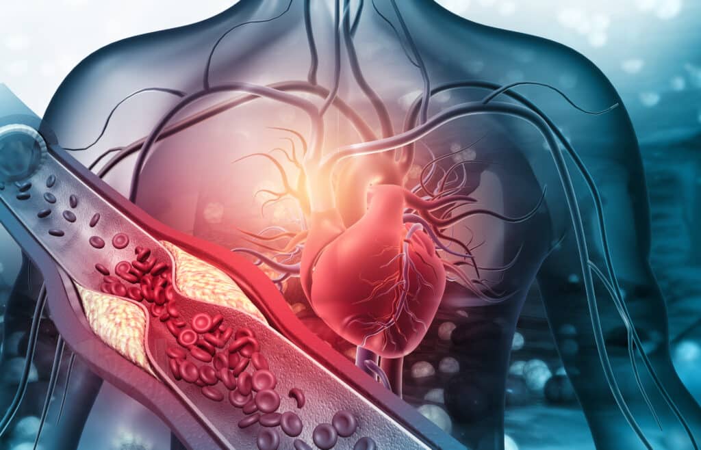 Hypertension Anatomy