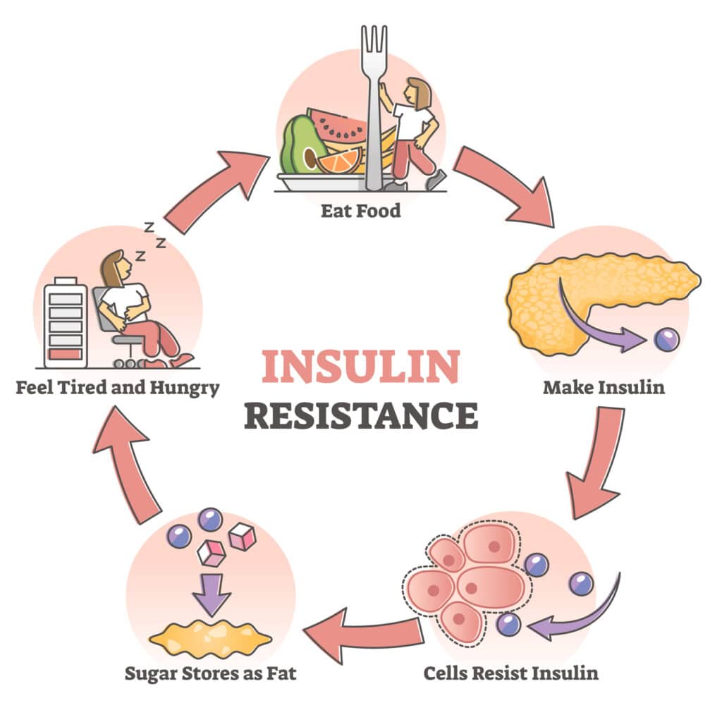Insulin Resistance Anatomy