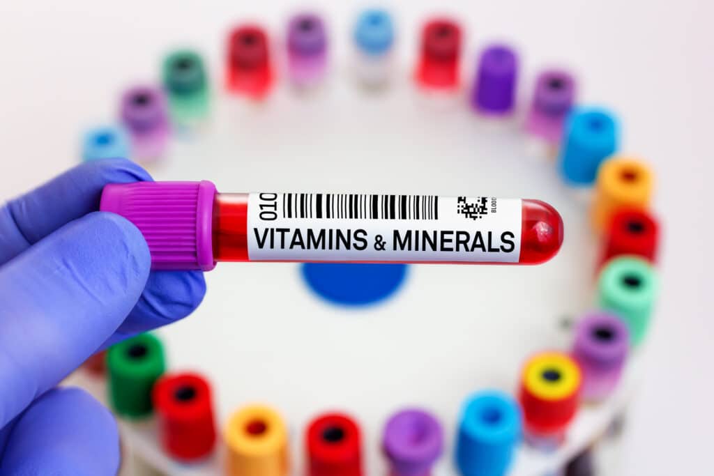 Mineral Deficiencies