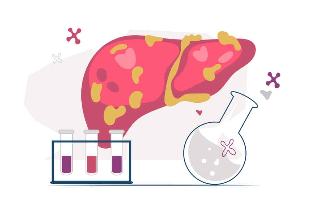 NAFLD Anatomy