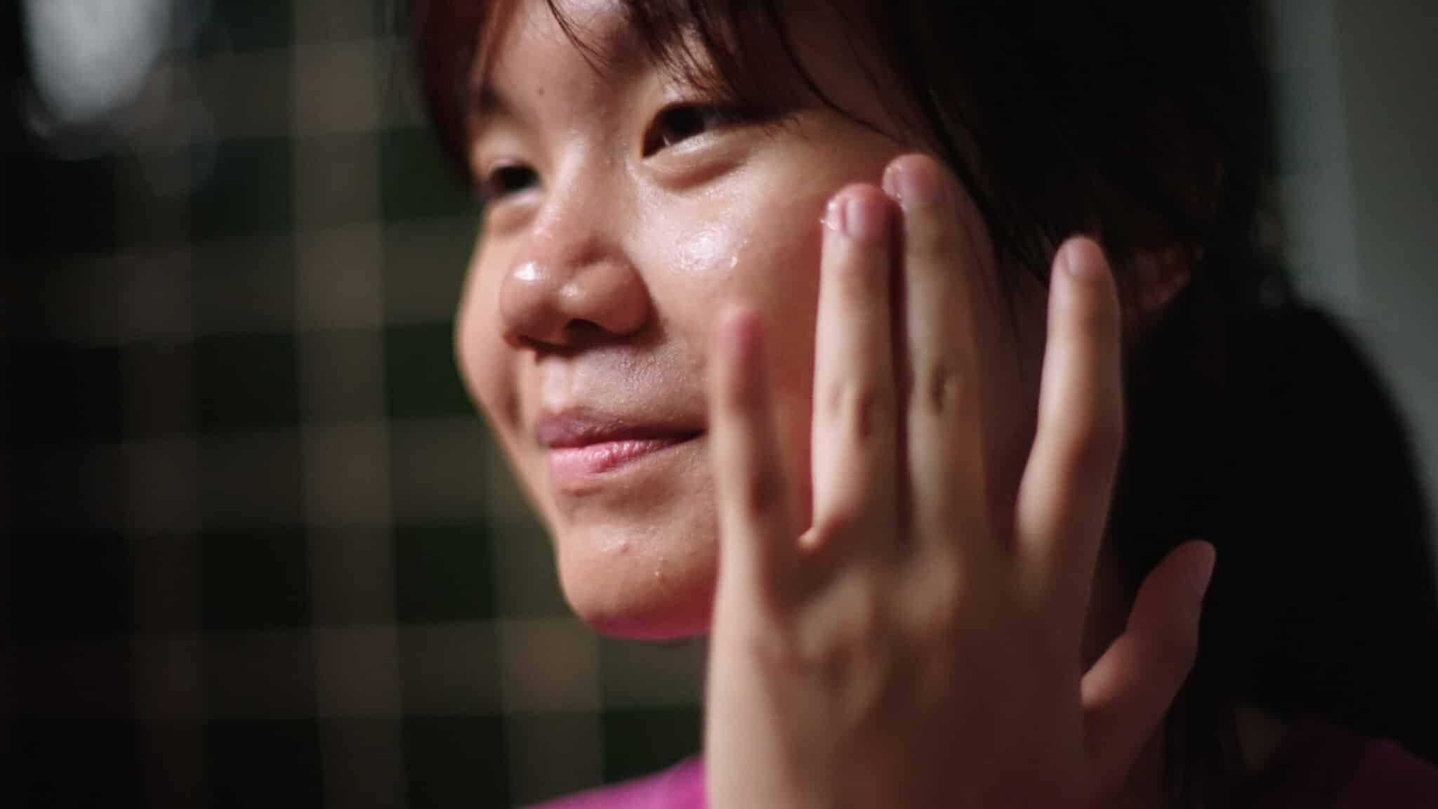 How Do You Fix Acne?