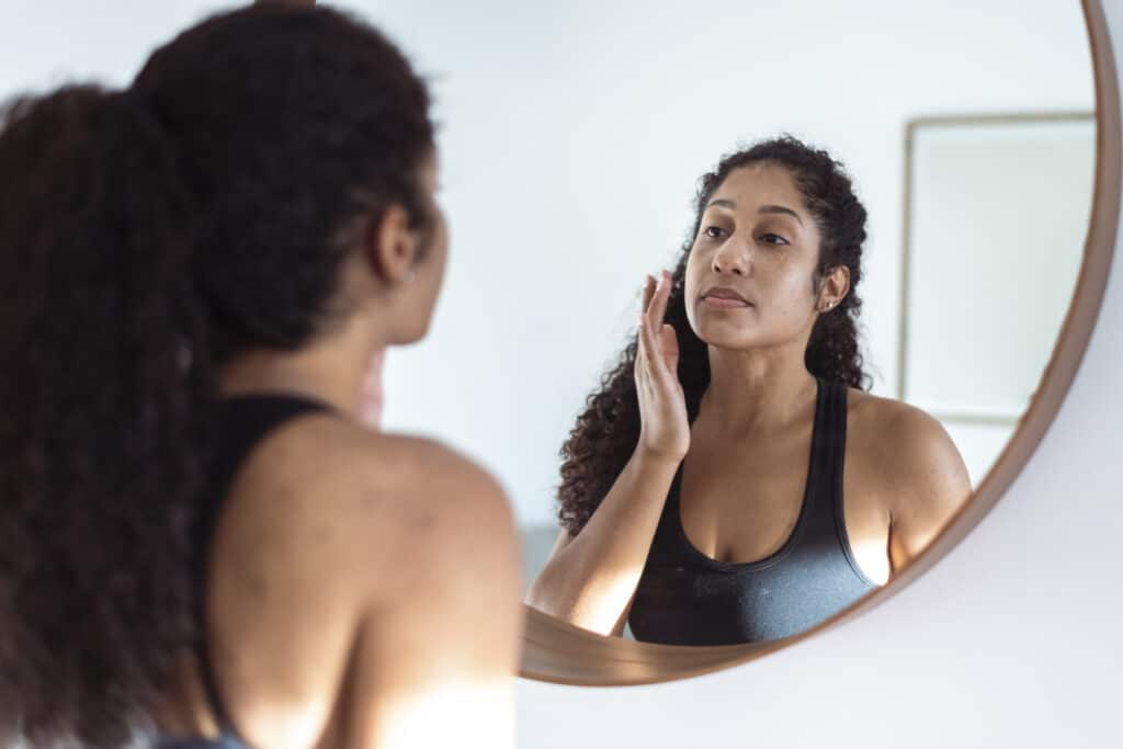 How Long Does Acne Last?