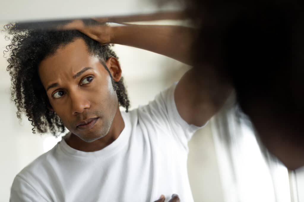 Hair Loss Anatomy