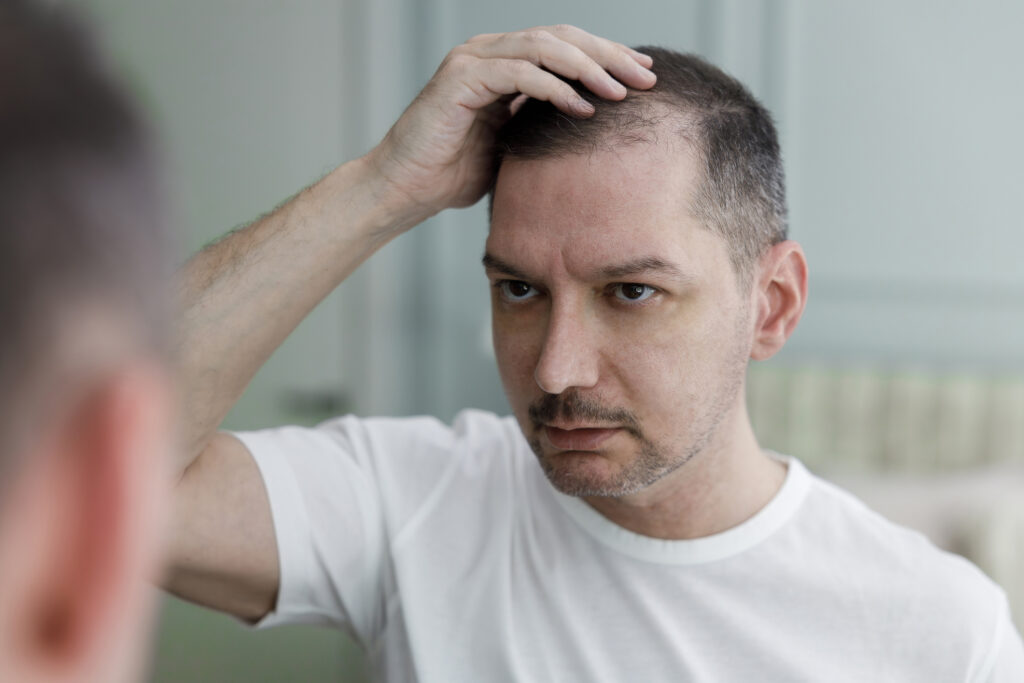 What Triggers Hair Loss?
