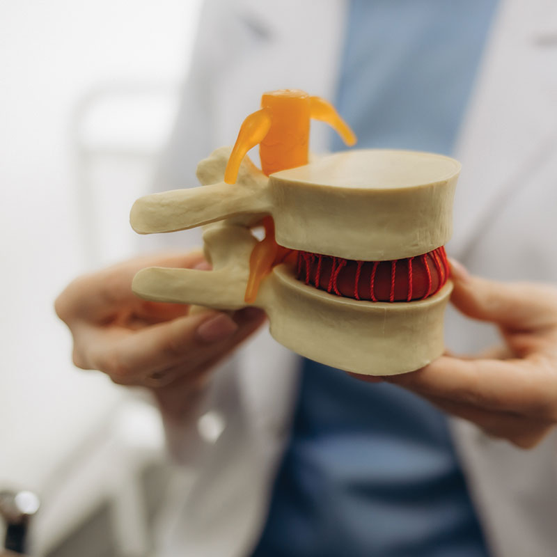 doctor showing ankylosing spondylitis