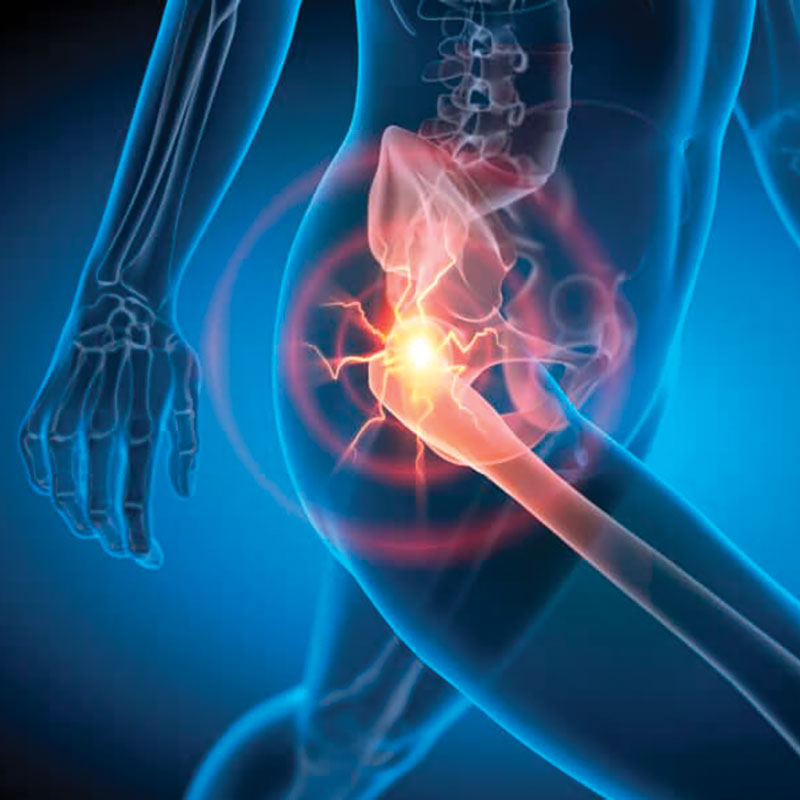 graphic depicting pain from greater trochanteric pain syndrome