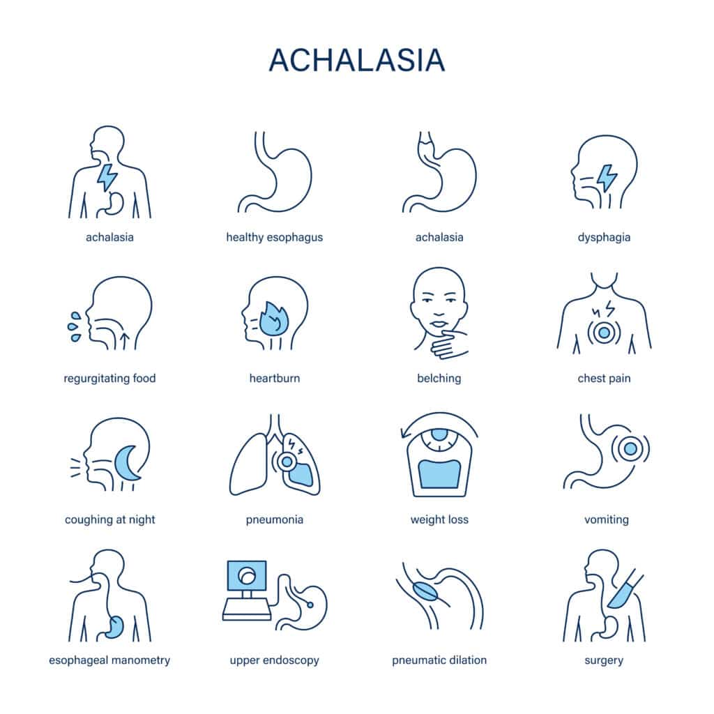 achalasia diagram
