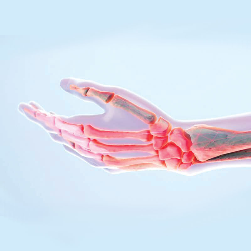 anatomical diagram of hand and finger pain