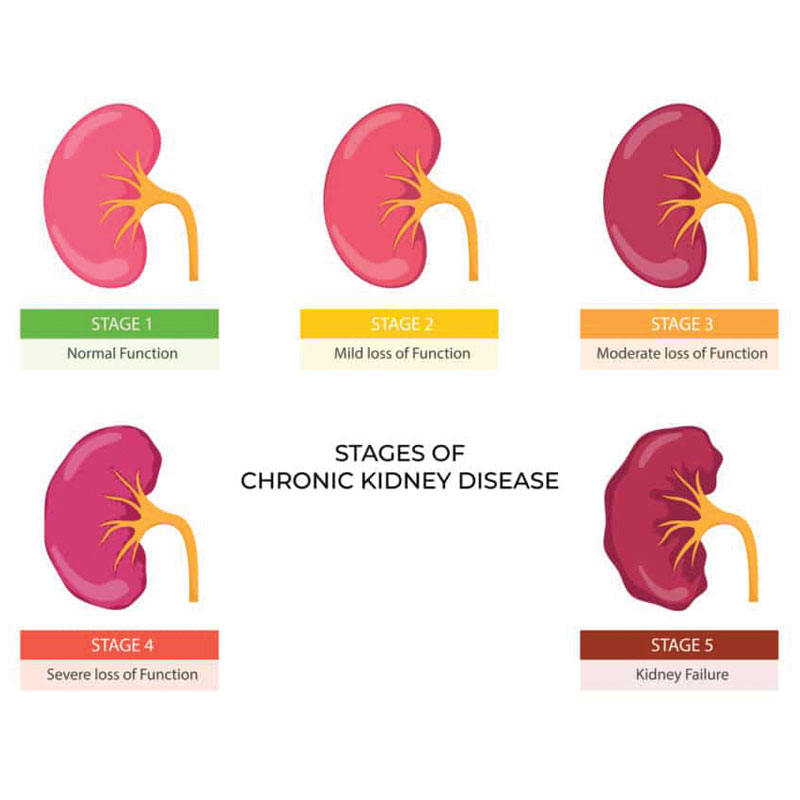 diagram of chronic kidney disease