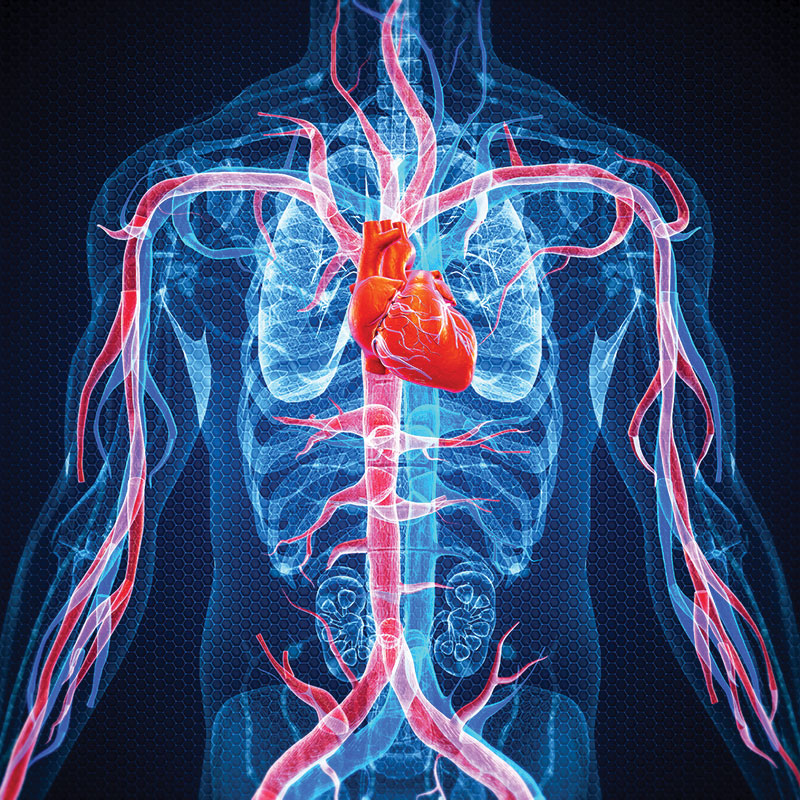 depiction of cardiovascular disease