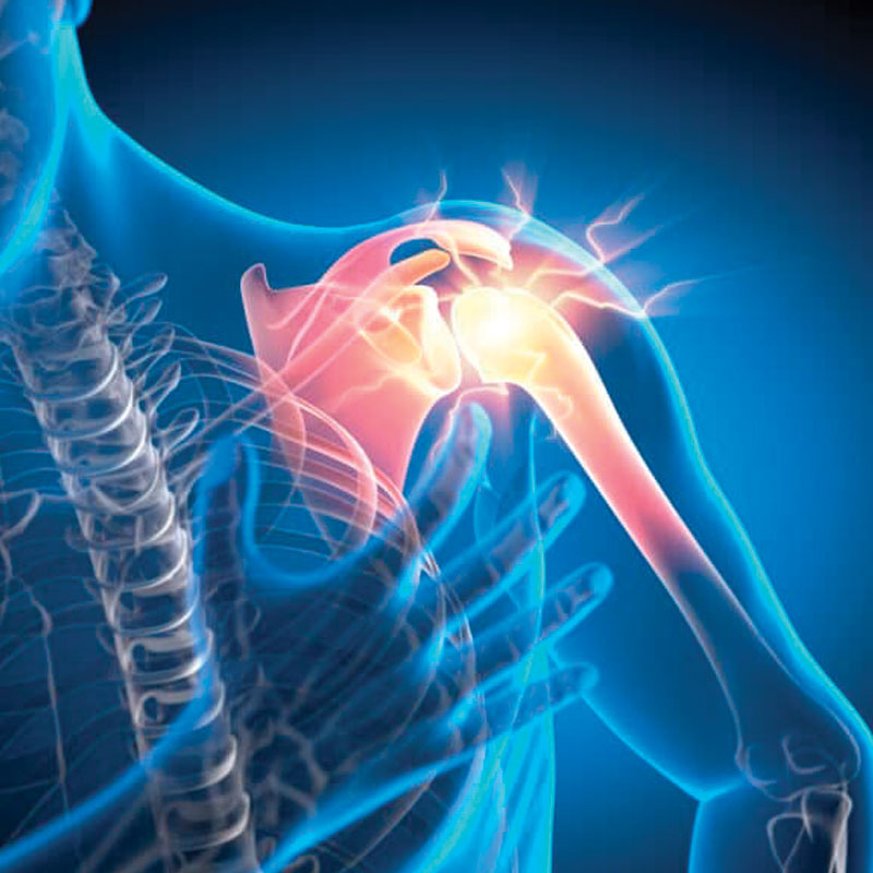 graphic showing frozen shoulder pain