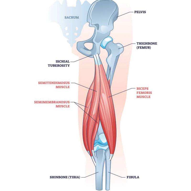 hamstring tendinopathy anatomy
