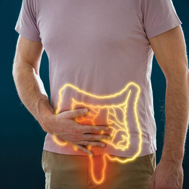 hemorrhoids anatomy illustration