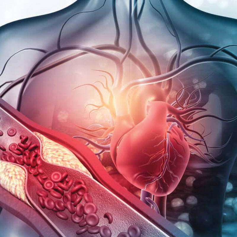 hypertension graphic