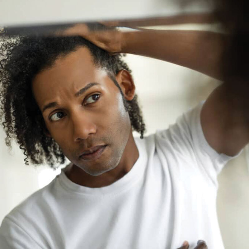 man looking in the mirror at his hair loss