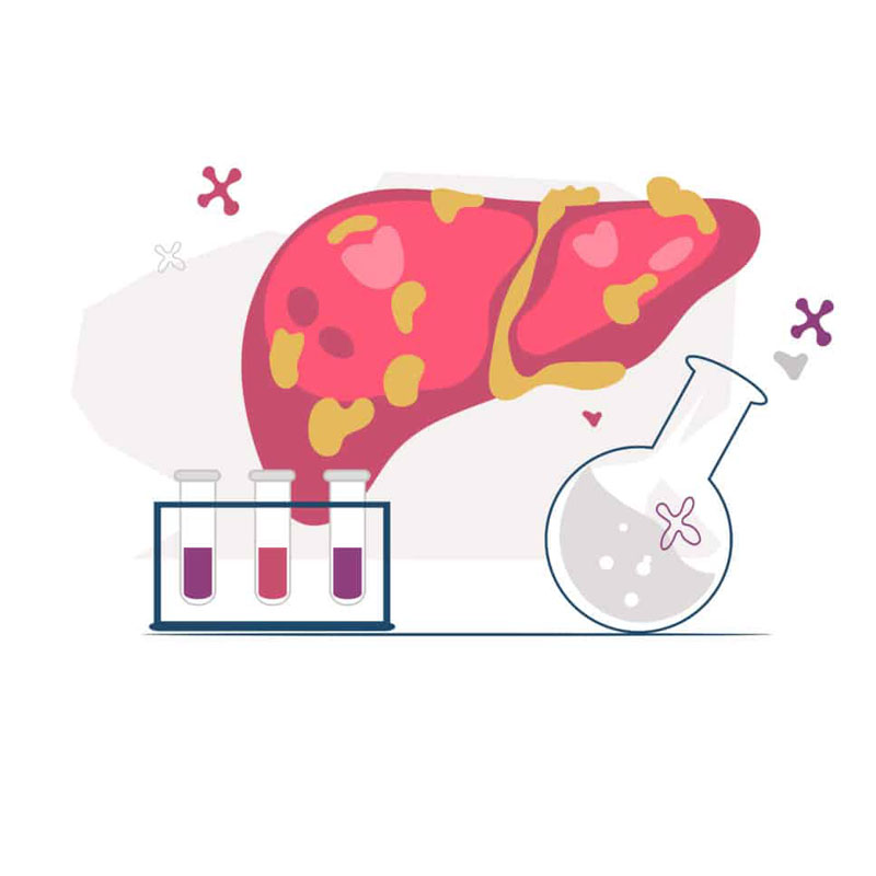 diagram of nafld