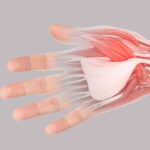 Thumb Strain - CARESPACE Health+Wellness