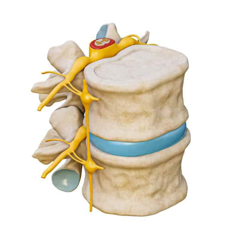 diagram showing lumbar stenosis