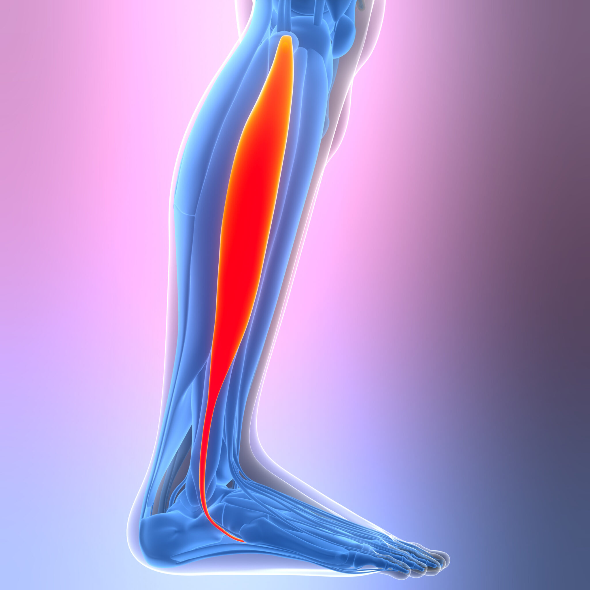 diagram of peroneal tendinopathy