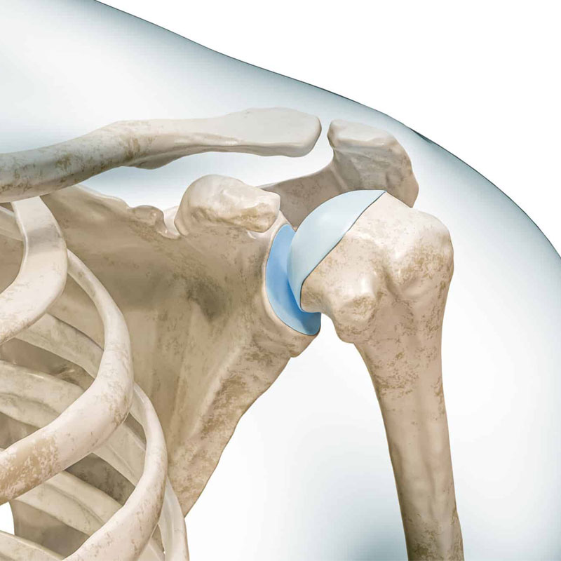 diagram of shoulder instability