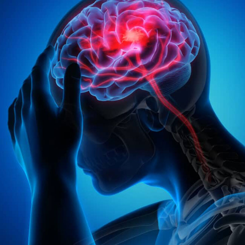 graphic showing migraines and headaches