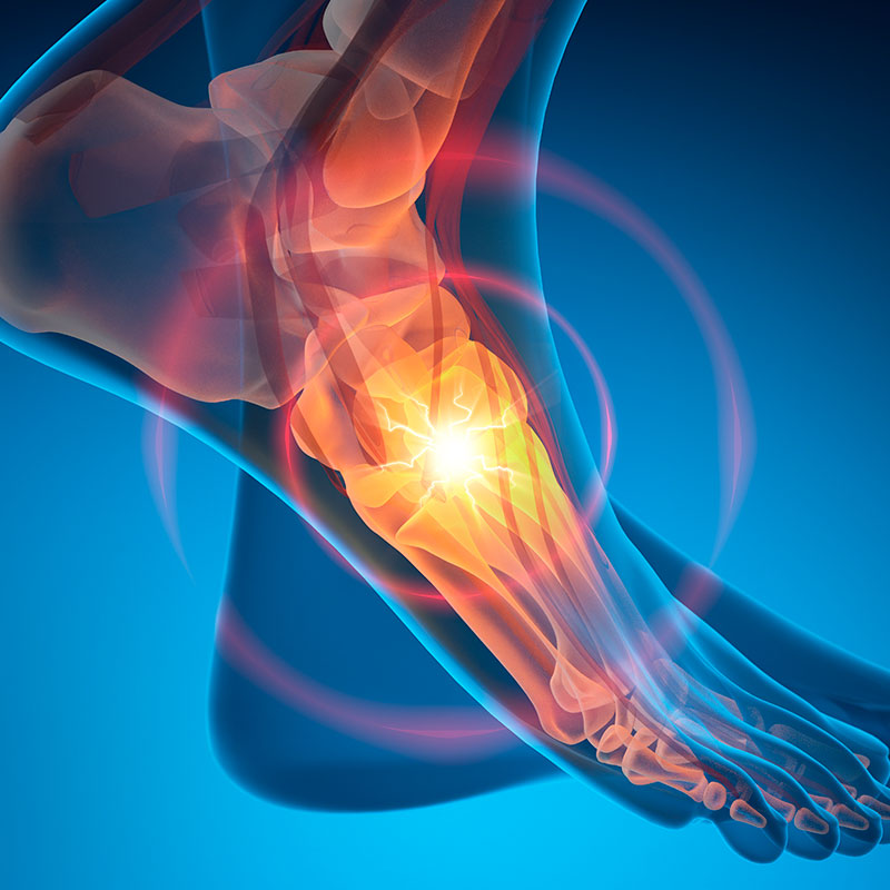 illustration of ankle and foot pain