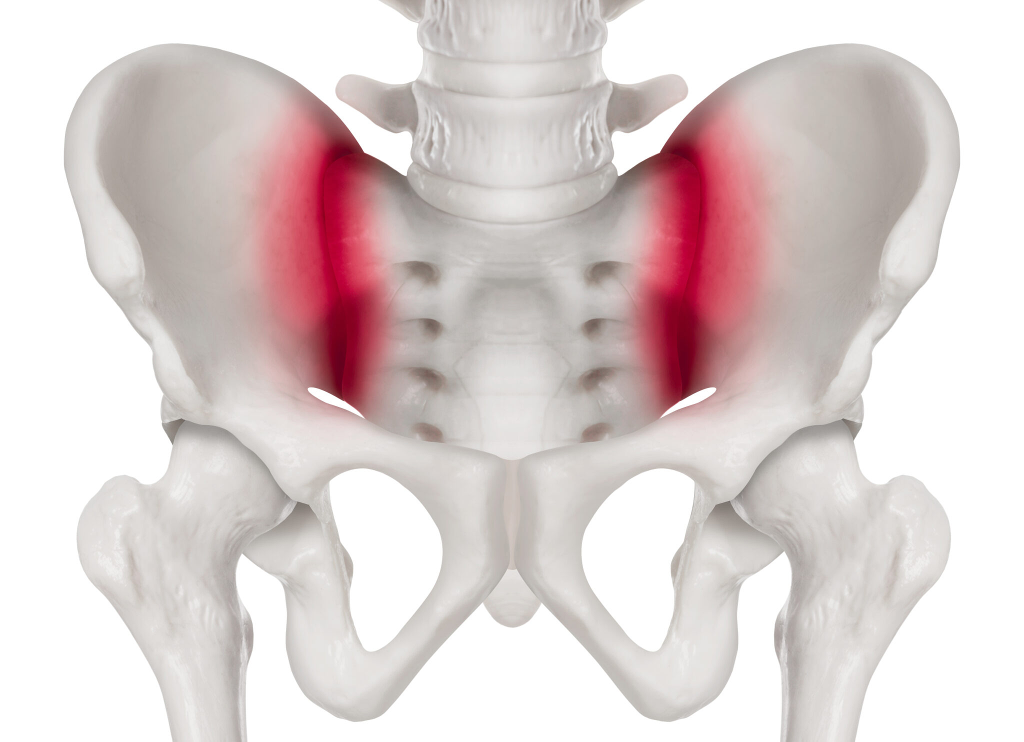 diagram of si joint irritiation