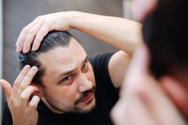 Does Hair Loss Stop on Its Own?